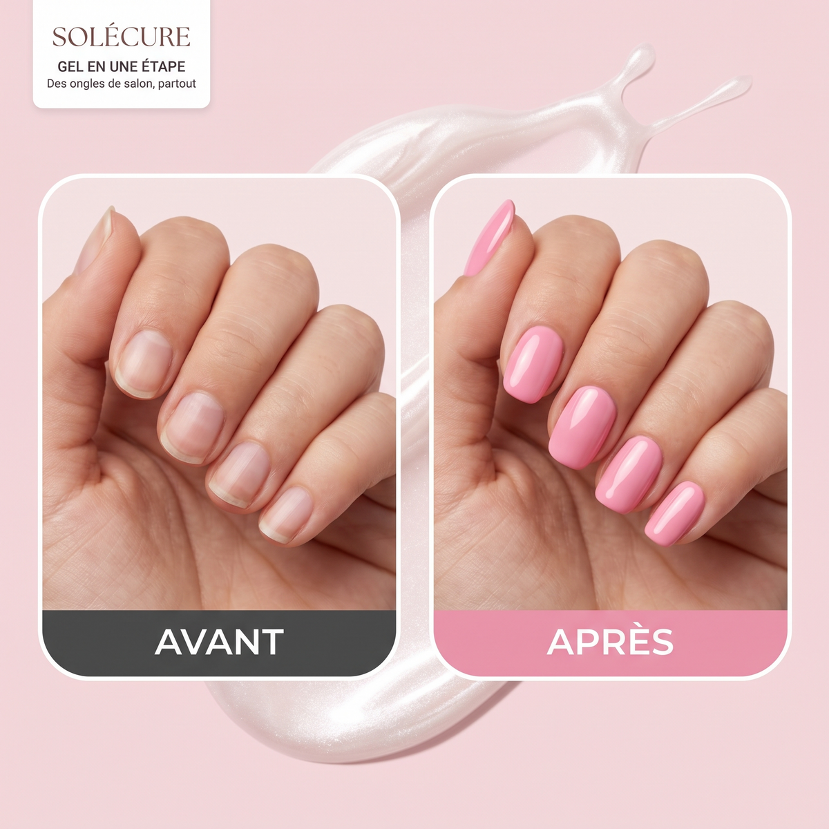 SOLÉCURE — Avant / après SOLÉCURE